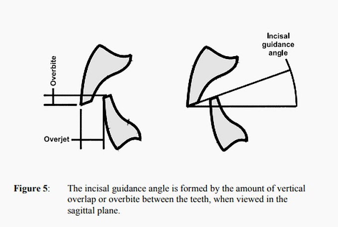 PDF: Occlusion in Complete Dentures - C P Owen 