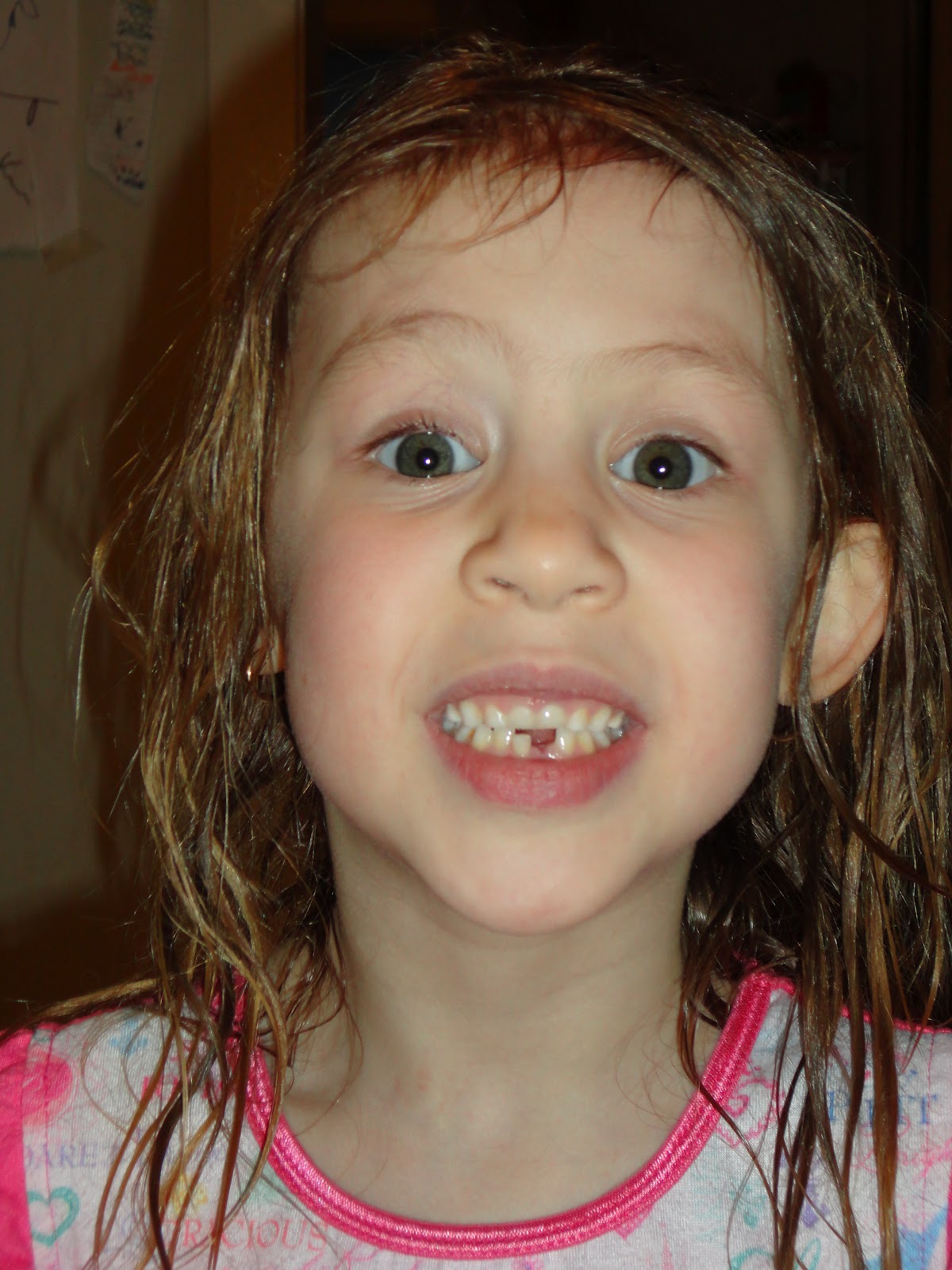 Davis Family Log Lost tooth and my fashion forward girl