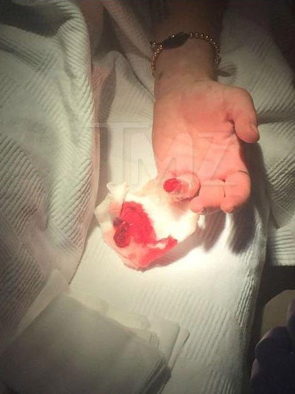 Se filtran fuertes imágenes del dedo de Lindsay Lohan antes de la operación Lindsay-lohan-foto-dedo-cortado-3.jpg.imgw.1280.1280