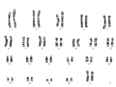 Normal human female chromosomes