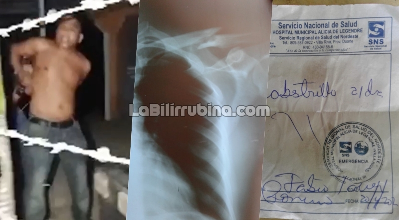 Video | Comerciante denuncia abuso policial en Villa Riva Fabio Samuel Taveras