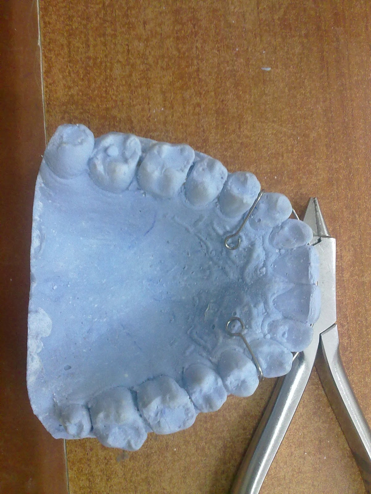 جهاز التثبيت (retainer) Smile maker