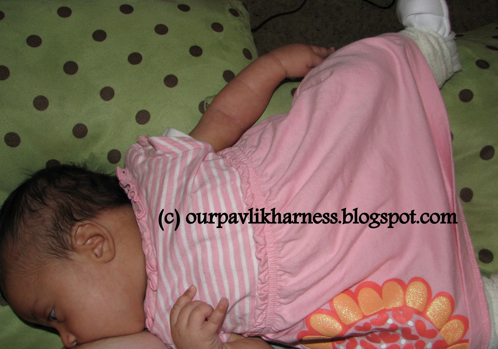 Our Pavlik Harness and journey with Hip Dysplasia Breastfeeding with