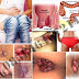Benjolan Nyeri di Pinggir Anus Apa Wasir thumbnail