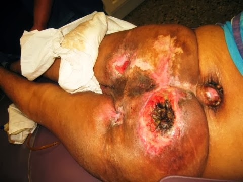 Stories in Medicine El Salvador Mission Trip 2012 - Part 