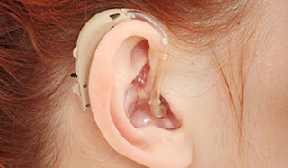 BTE Hearing Aid