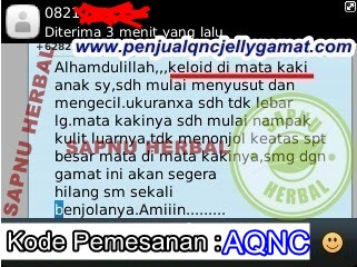Obat Penghilang Keloid Pada Kulit Yang Ampuh Obat Penghilang Keloid Pada Kulit Yang Ampuh