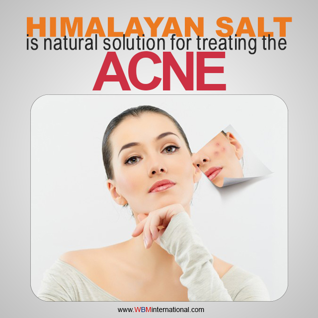Cure your acne with the naturally extracted Himalayan pink salt