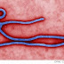 OMS analiza combatir con ZMapp el ébola en África Occidental
