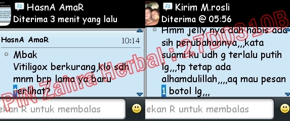 Cara Cepat Menghilangkan Putih-Putih Di Kulit Cara Cepat Menghilangkan Putih-Putih Di Kulit