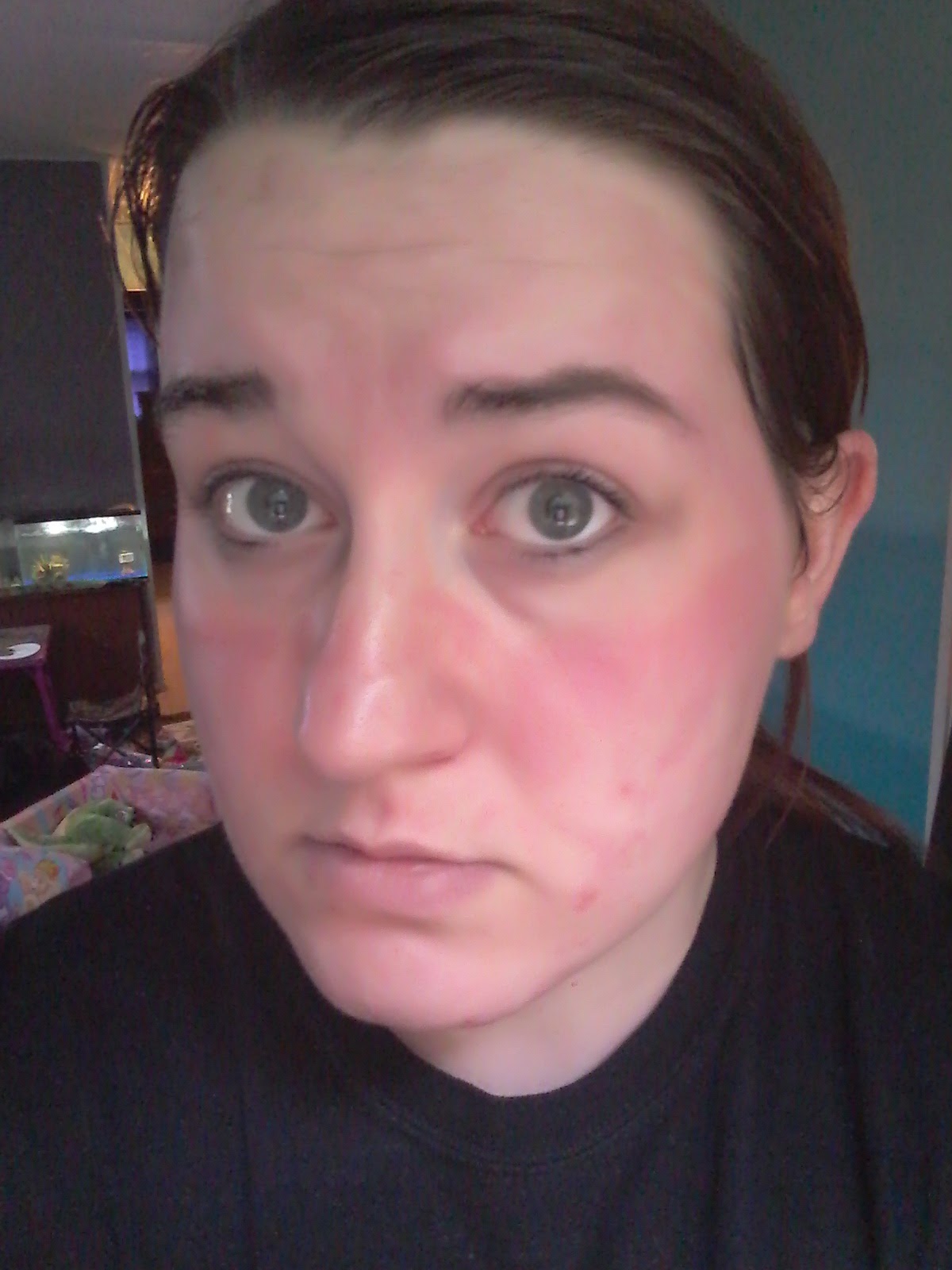 Reviews: Review of Makeup Allergic Reaction