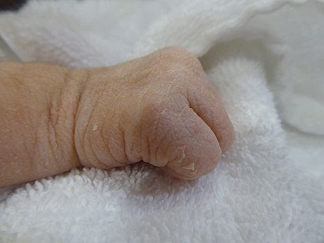 赤ちゃん誕生　新生児の手