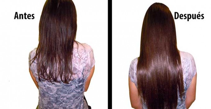 El quemazón sobre la cabeza a la caída de los cabello
