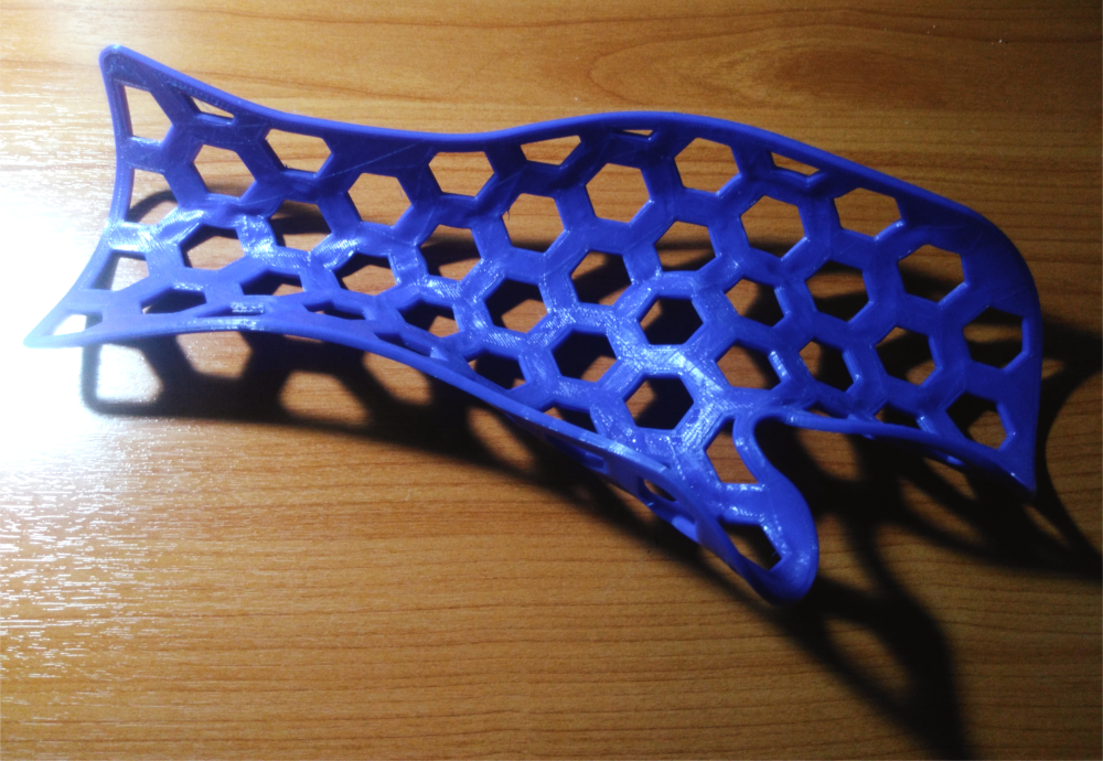 ProgressTH: 3D Printing: Resting Hand Splint Could Save Hospital ...
