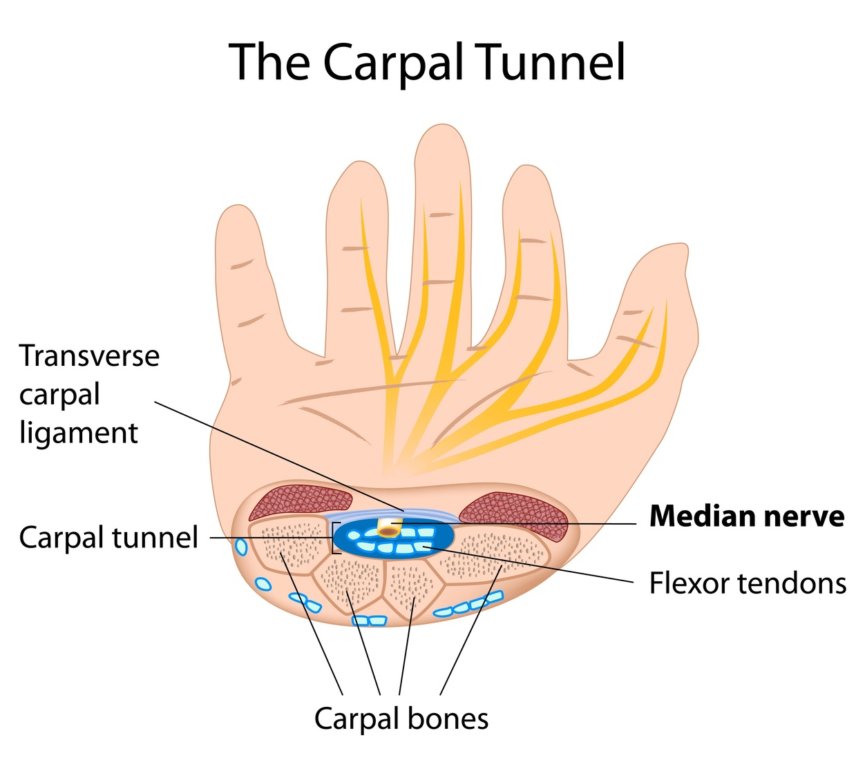 Numbness in Hands & Fingers Carpal Tunnel Syndrome? SIXTY PLUS