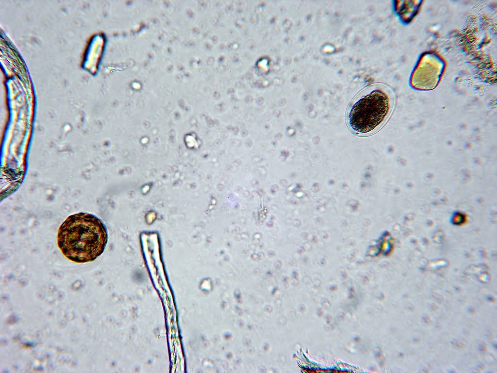 Споры в кале у взрослого. Цисты лямблии микроскопия. Яйца глистов микроскопия. Цисты лямблий микроскопия. Циста лямблии под микроскопом.
