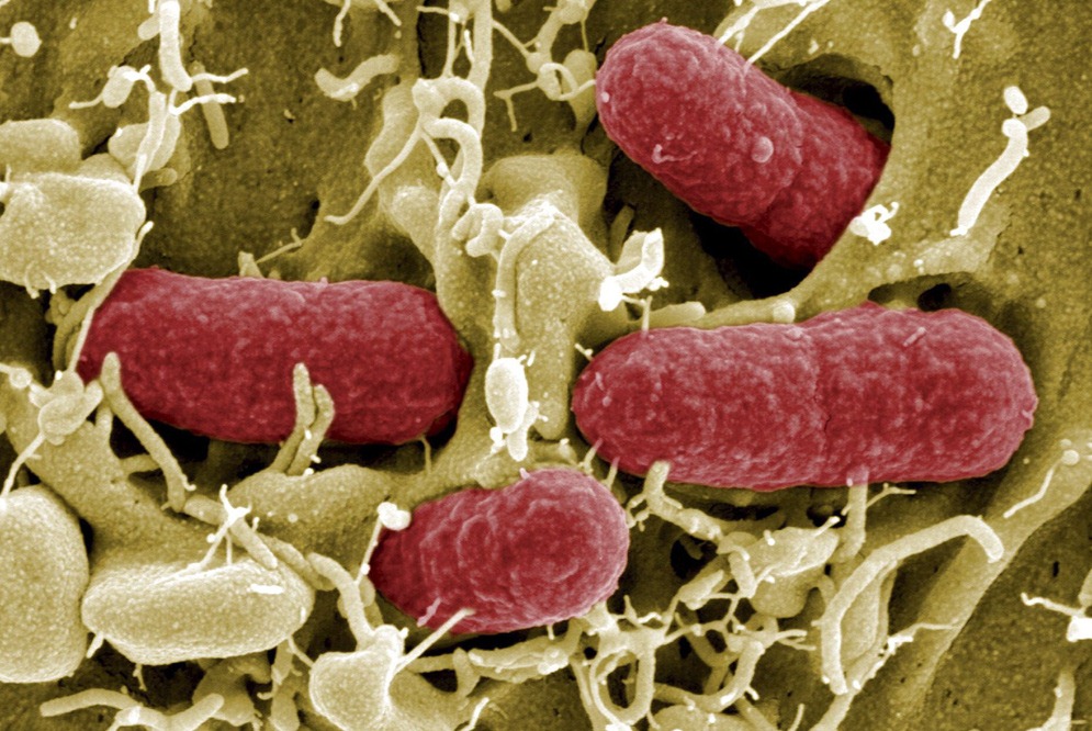 Bacterias que comen bacterias la nueva arma contra las superbacterias