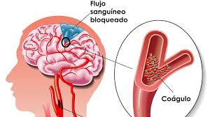 higiene bucal lesiones musculares higiene bucal lesiones musculares