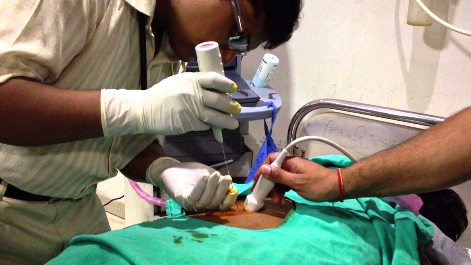 Внутрисуставная пункция плечевого сустава. Эпидуральная анестези. Укол для эпидуральной анестезии. Инфильтрационная эпидуральная анестезия. Эпидуральная анестезия игла.