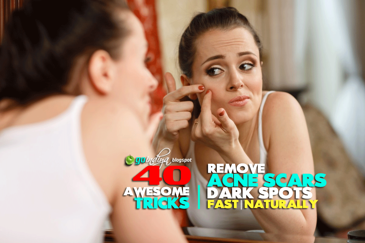 Remove Acne Scars, Dark Spots Fast 40 Best Natural Home Remedies Part 2 Natural Home