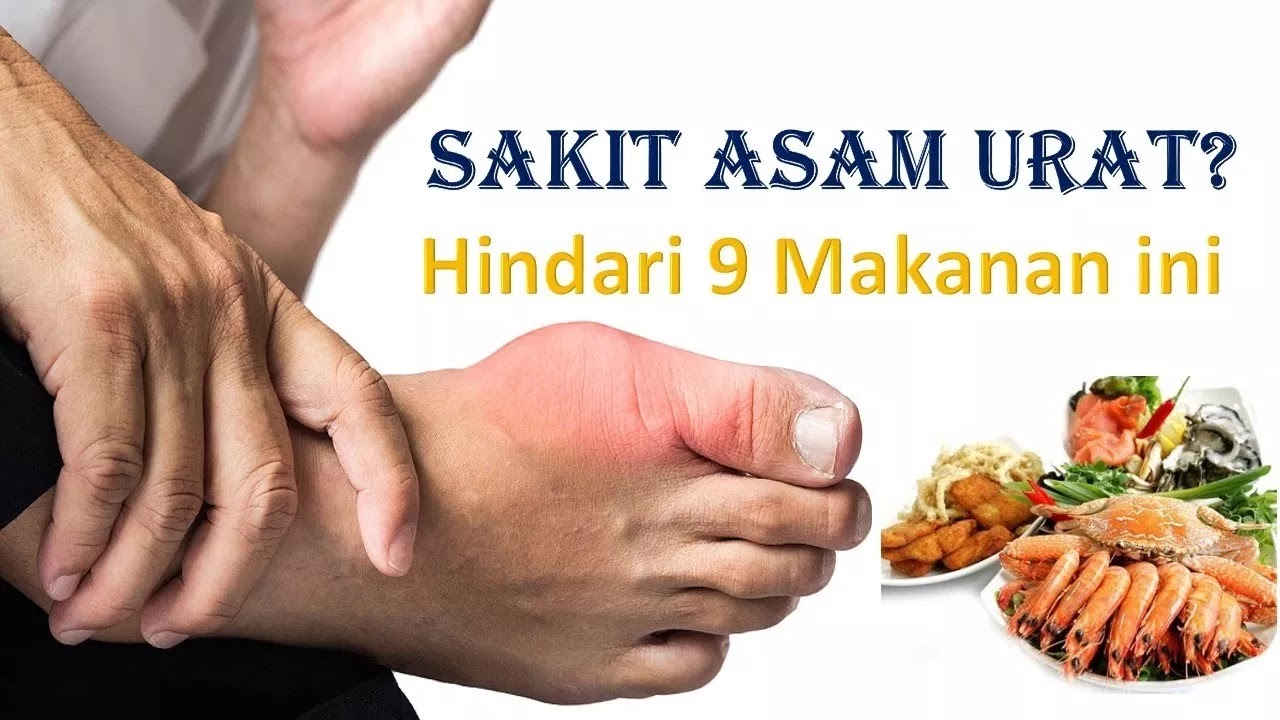 Inilah 9 Jenis Makanan Yang Berbahaya Bagi Penderita Asam Urat Inilah 9 Jenis Makanan Yang Berbahaya Bagi Penderita Asam Urat