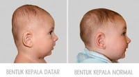 Bentuk kepala Bentuk kepala