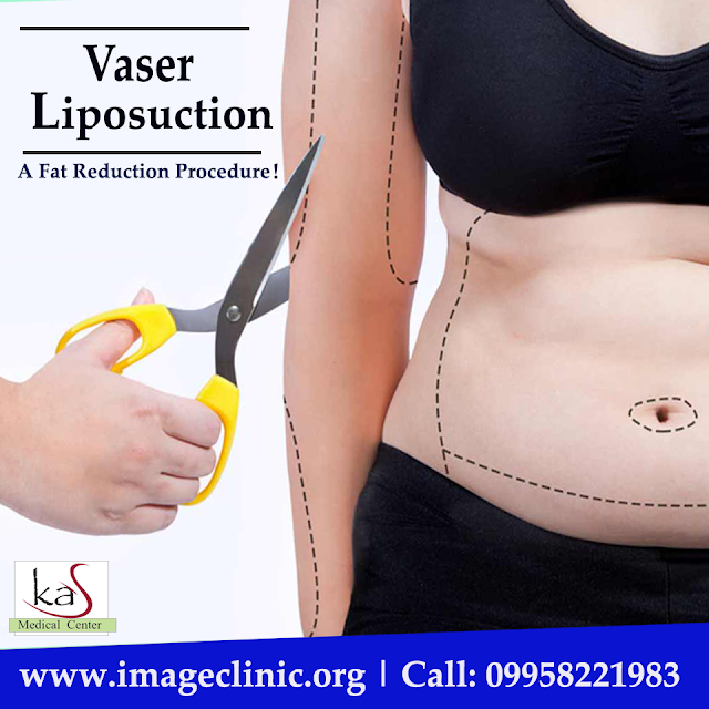 #VaserLiposuction #Liposuction #WeightLossSurgeon #CosmeticSurgery #Abdominoplasty #Delhi #India