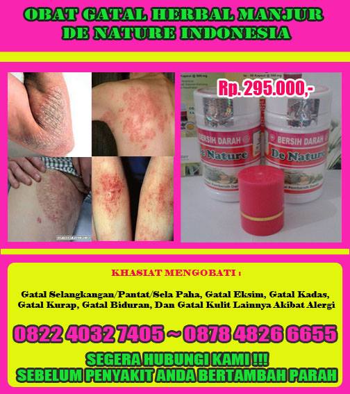 toko herbal kita: Cara Menghilangkan Gatal-Gatal di Selangkangan Paha