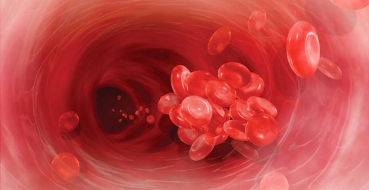 8 Evidence That You Have A Blood Clot And Need To Act Quickly