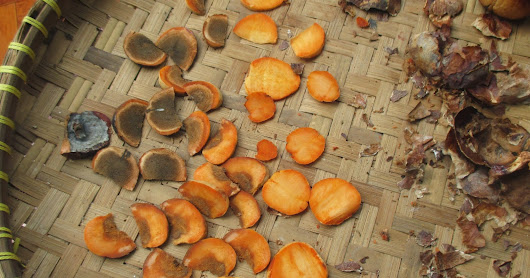 TERNYATA BIAYA UNTUK CUCI GINJAL KURANG DARI : RP. 10.000 SAJA ! (((BEGINI CARANYA))) TOLONG SEBAR LUASKAN..!!