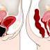 Remove Toxins from the Colon by Applying Pressure on This Point on Your Belly!!!