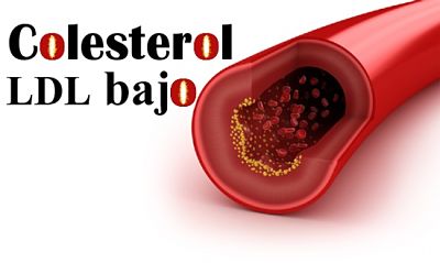 que significa colesterol ldl bajo