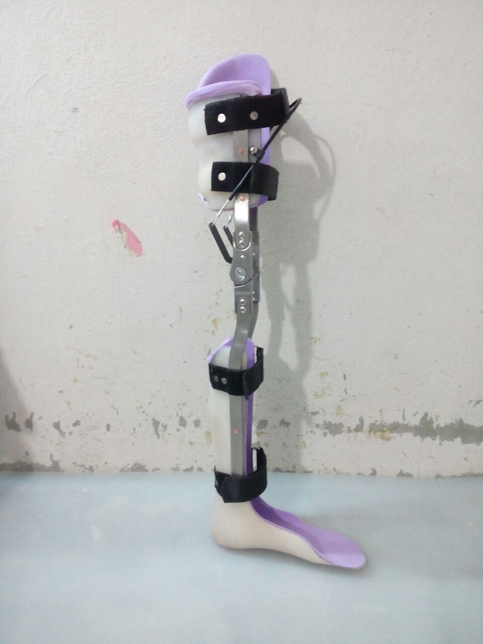 Prosthetics & Orthotics from My Care Calipers for Polio Patients (KAFO)