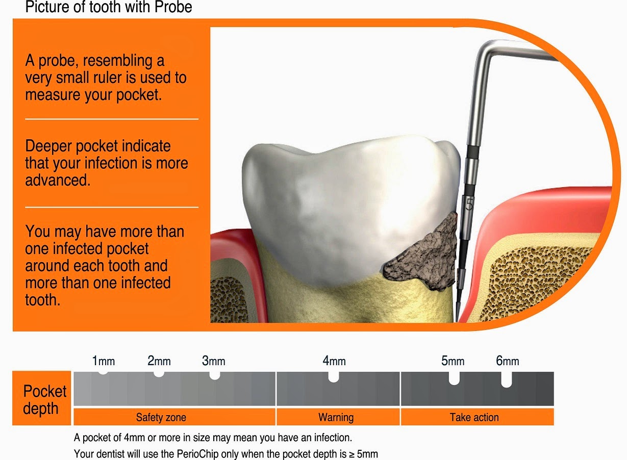 The Dental Tourist 35 APPOINTMENT 3 / TRIP 2 GONZALEZ