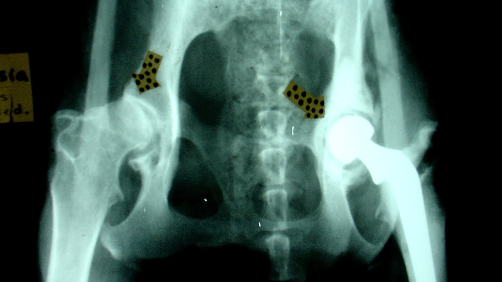 Hip Dysplasia Surgery In Dogs Dog Choices