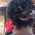 JIJIK BETUL !!!... Ular Bersarang Dalam Rambut Lelaki Ini Selama Hampir 3 Tahun ! Malang Tidak Berbau, Lihat KESAN Yang Berlaku ke Atas KULIT Kepalanya... BERANI NAK TENGOK???