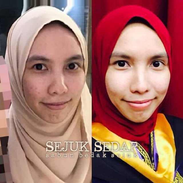 sabun bedak sejuk SS _ muka sejuk sedap sabun bedak sejuk SS _ muka sejuk sedap