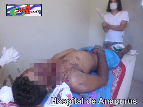Urgente: Homem se depara com arame farpado que causa sua morte imediata em Carnaúba Município de Anapurus