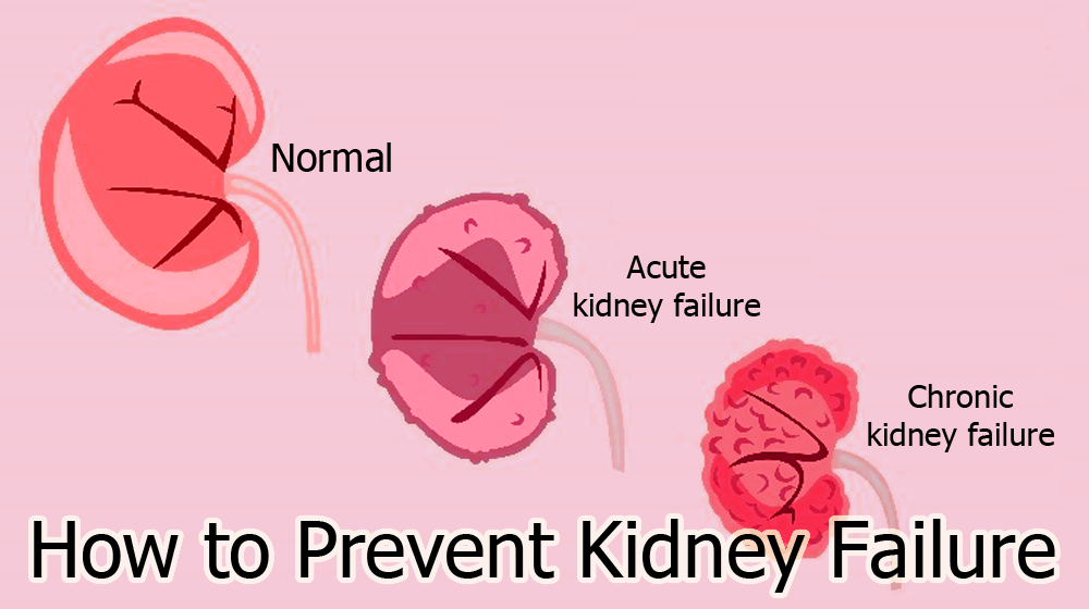 how-to-prevent-kidney-failure