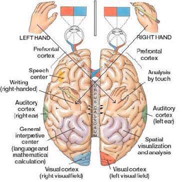 Stroke Wise: All about your brain