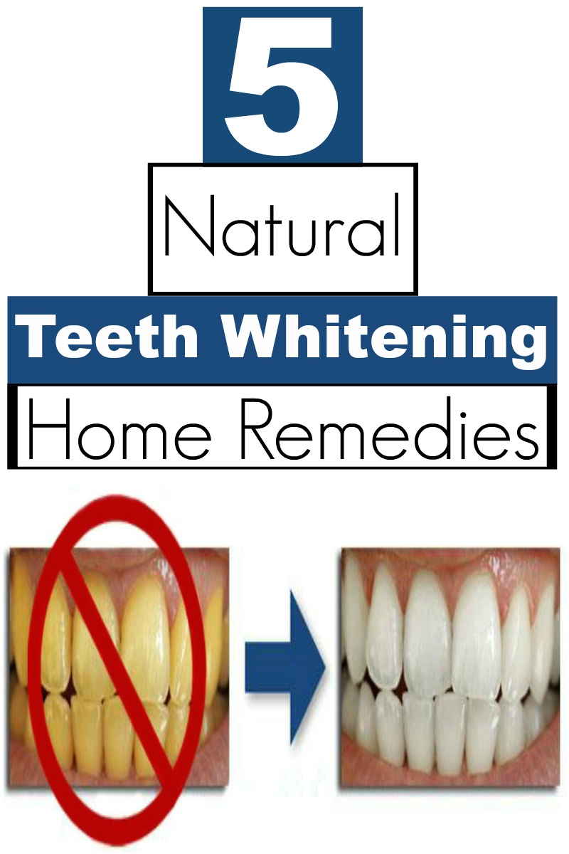 Natural Skin Healing 5 Natural Teeth Whitening Home Remedies