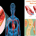 How To Easily Lower Your Bad Cholesterol Using Natural Ways!
