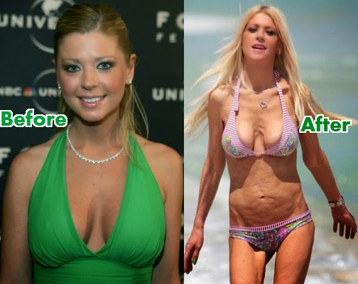 tara reid anorexia