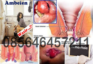 Obat Hemoroid (Wasir) Oral Ambejoss Zaitop Obat Hemoroid (Wasir) Oral Ambejoss Zaitop