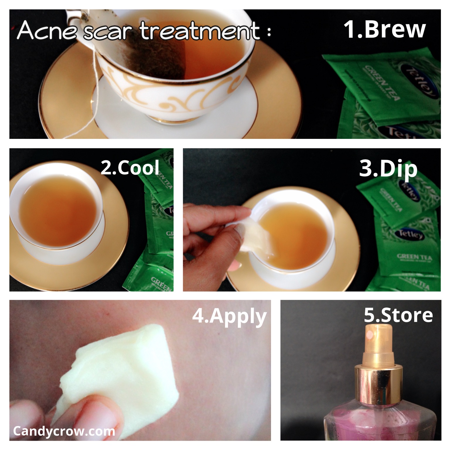 Green Tea for Acne Scars, how to clear acne scars