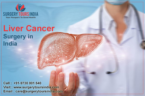 Liver Cancer Surgery India