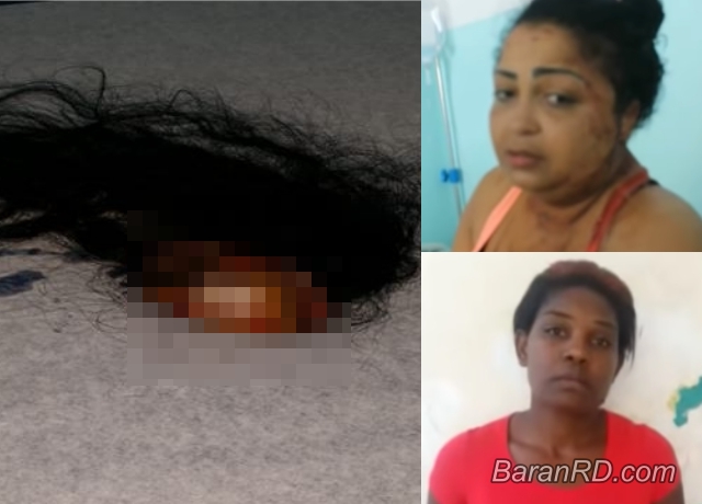 Video: Le arrancan cuero cabelludo por deuda de pelo postizo en Samaná Yeisi Ramírez Zabala y Melania Jhones Williams