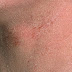 Is There Away To Get Thyroid T Naturally Is There Away To Get Thyroid T Naturally