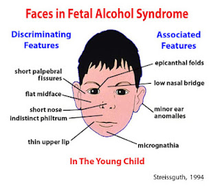 Putnam County Communities That Care Coalition: FASD Awareness Day 9.9.12