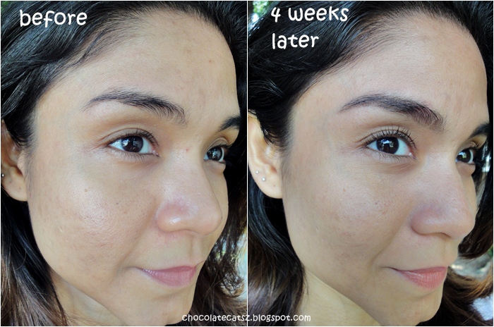 clinique smart night before and after